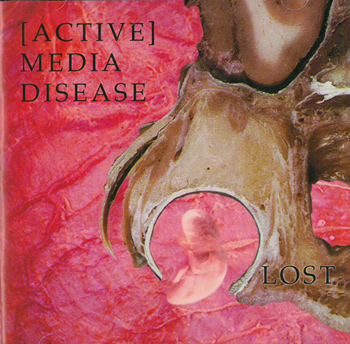 Active Media Disease Lost MCD 601756